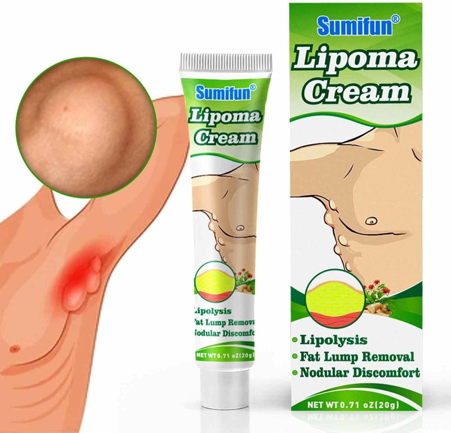 Crème d'élimination de lipomes