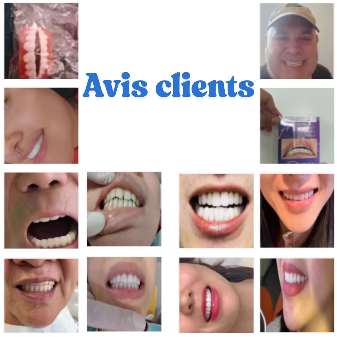 🦷 Ensemble de prothèses dentaires en silicone.