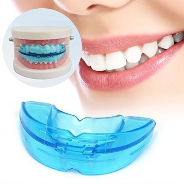 Appareil orthodontique en silicone.