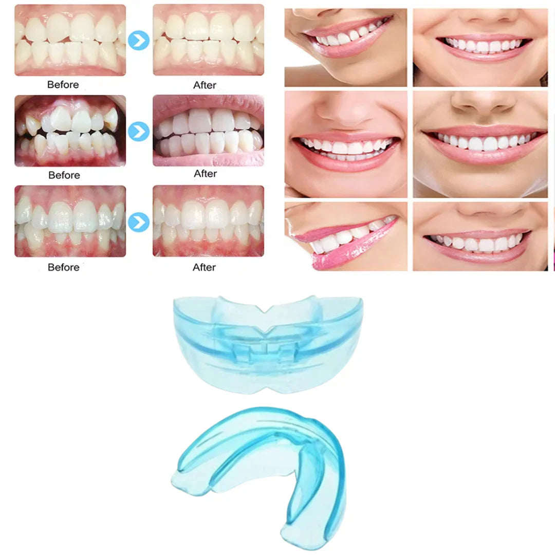 Appareil orthodontique en silicone.