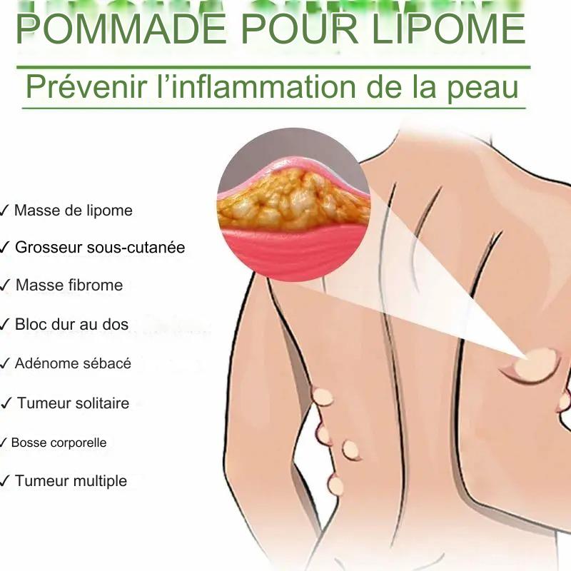 Crème d'élimination de lipomes