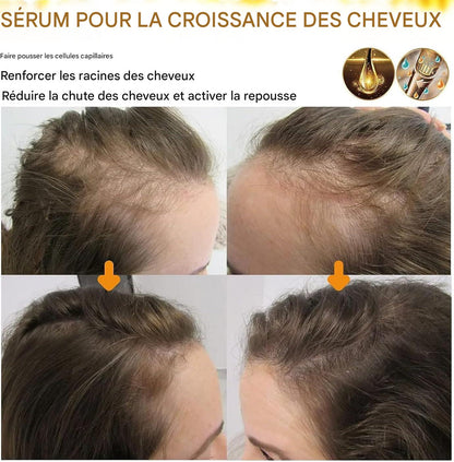 BIOTIN™ est la solution ultime pour se débarrasser de la calvitie