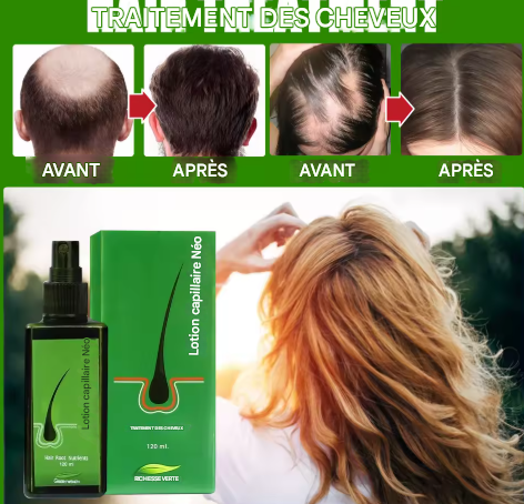 L'huile sérum de croissance capillaire