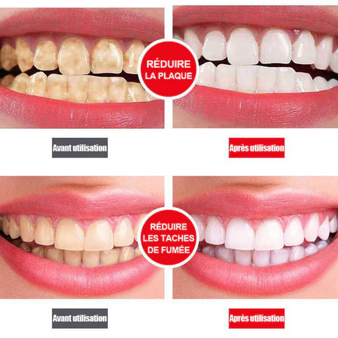 Dentifrice blanchissant SP-4.