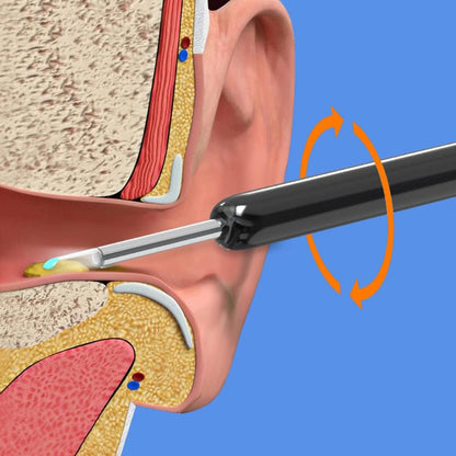 Nettoyeur d'oreilles avec caméra.
