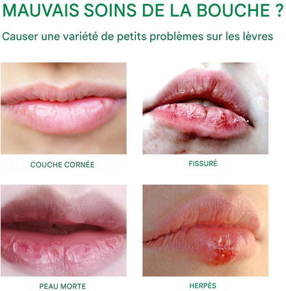 Meilleur Baume à Lèvres.
