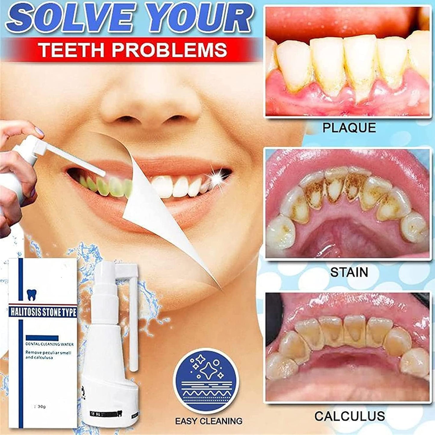 Spray de Nettoyage de Calcul Dentaire.