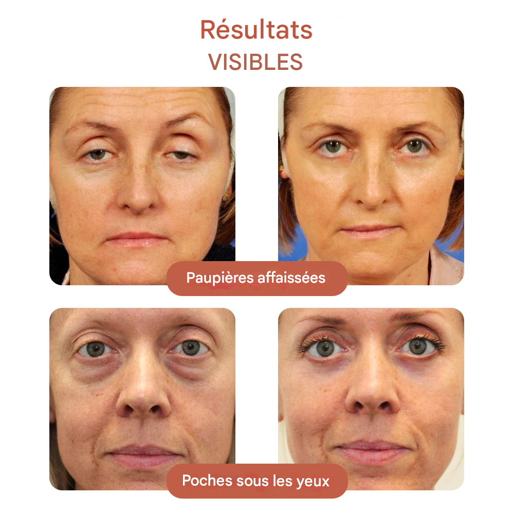 Crème Contour des Yeux Réparatrice & Anti-Cernes