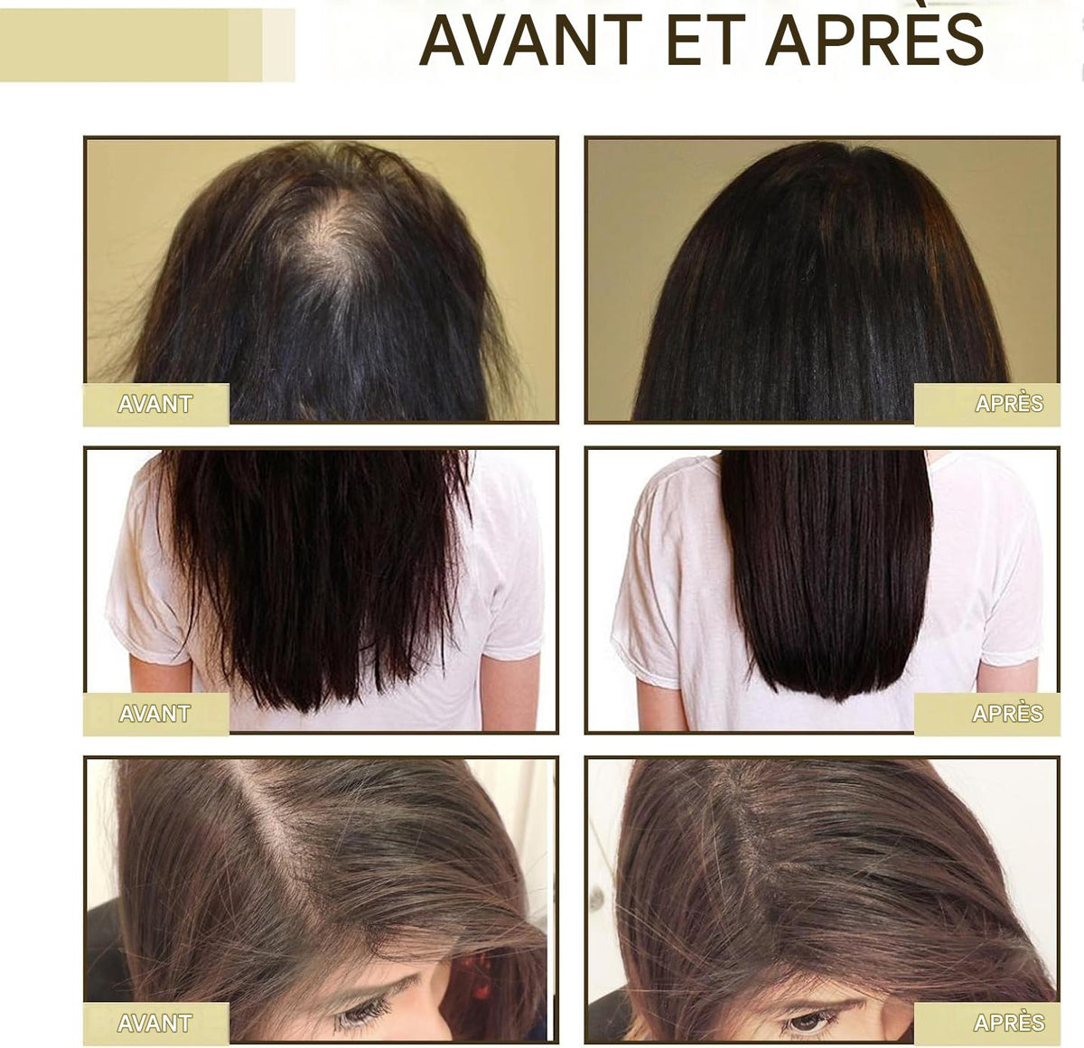 Huile de Croissance Capillaire EELHOE Burkina