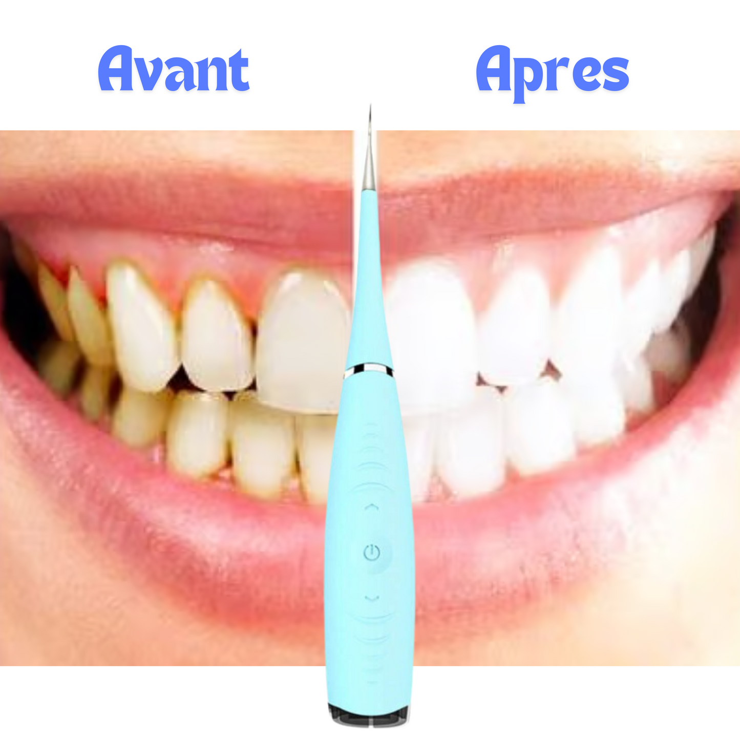 Dissolvant de tartre dentaire électrique.