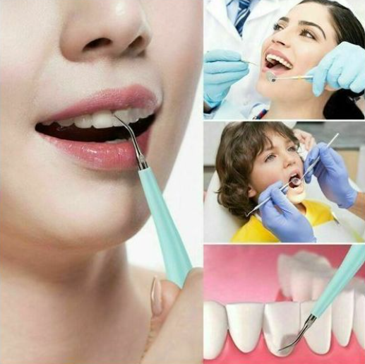 Dissolvant de tartre dentaire électrique.