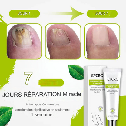 EFERO - Gel anti-fongique des ongles.