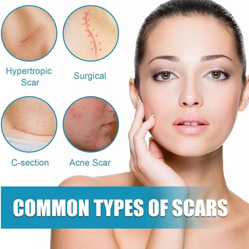 OUHOE-Gel Anti Cicatrices.