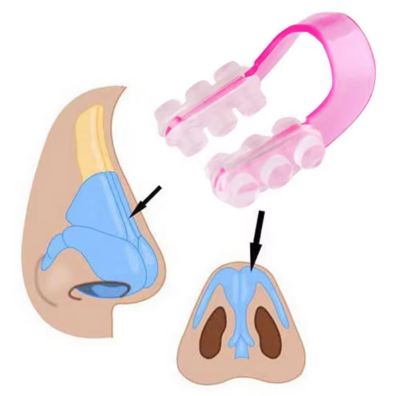 Clip-nez pour le lifting et la mise en forme du nez en forme de U.