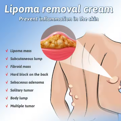 SOUTH MOON-LIPOMA REMOVAL SPRAY.