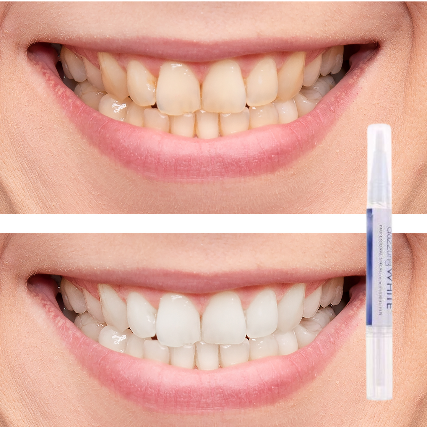 Stylo Blanchiment Dentaire Instantané