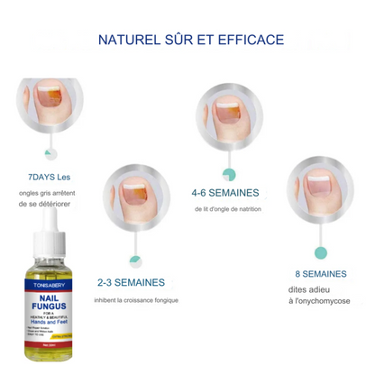 Sérum à ongles antifongique et anti-infectieux
