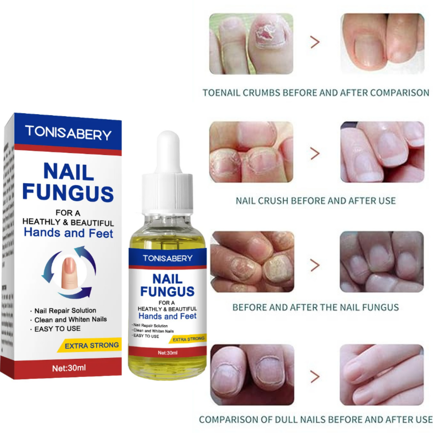 Sérum à ongles antifongique et anti-infectieux