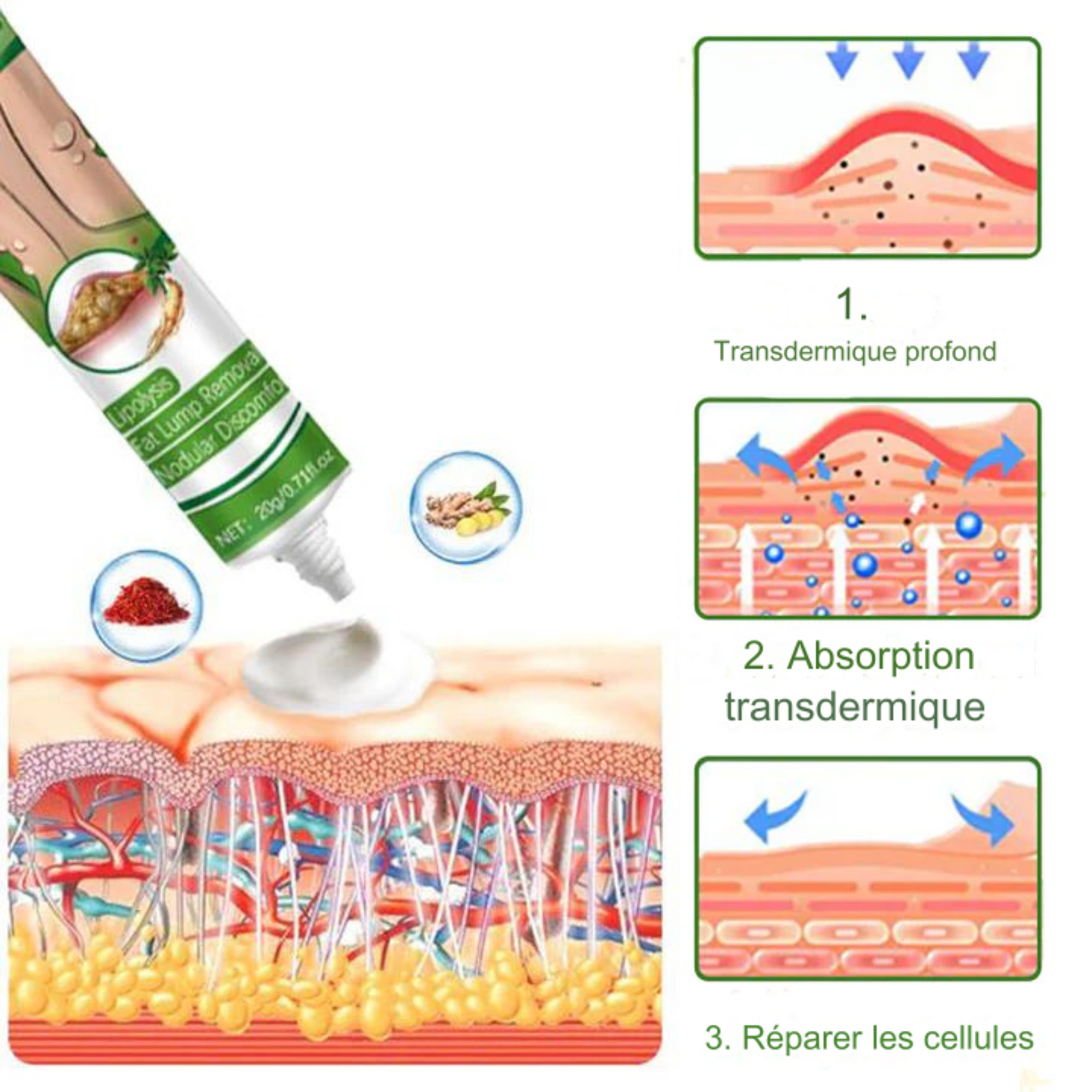 Crème d'élimination de lipomes