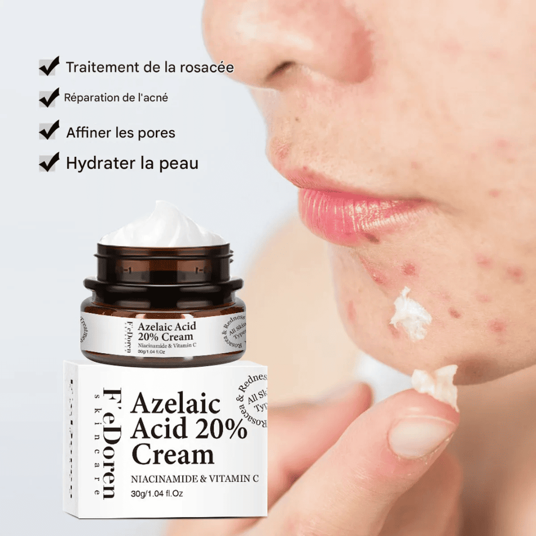 Dites adieu aux boutons et aux taches avec la crème Azelaic Acid 20%