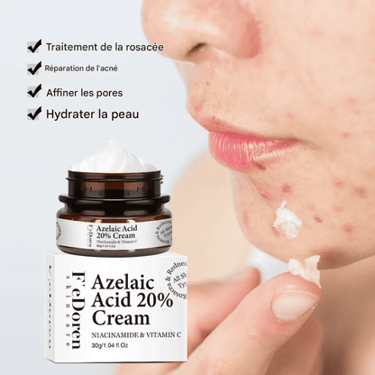 Dites adieu aux boutons et aux taches avec la crème Azelaic Acid 20%