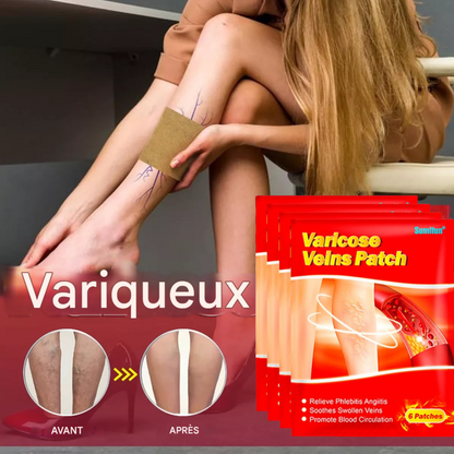 6 patchs pour éliminer les varices.