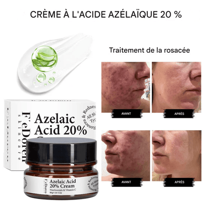 Dites adieu aux boutons et aux taches avec la crème Azelaic Acid 20%