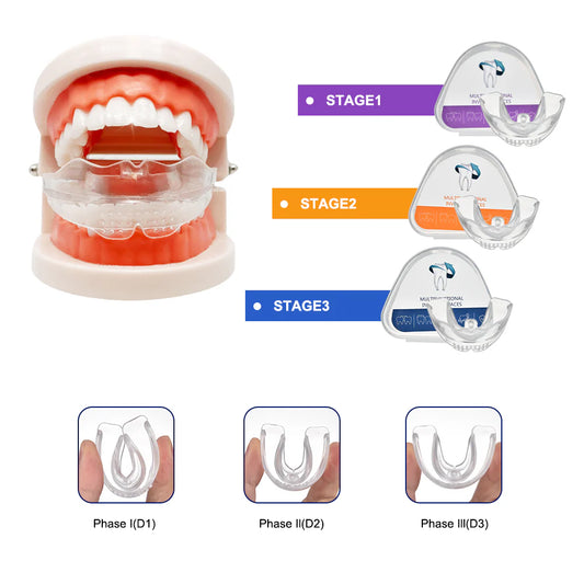 Appareil orthodontique en 3 étapes.