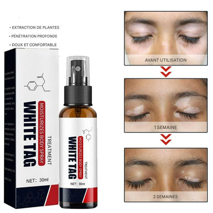 Spray Réparateur pour Vitiligo & Psoriasis.