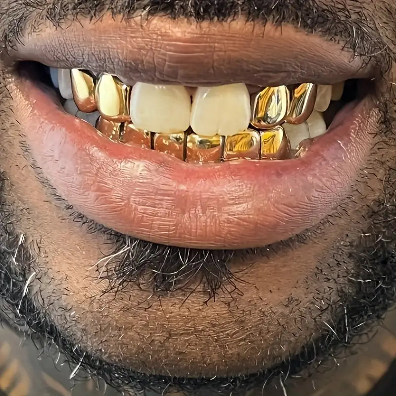 Grills Dents Dorées & Argentées – Brille comme une Star ✨