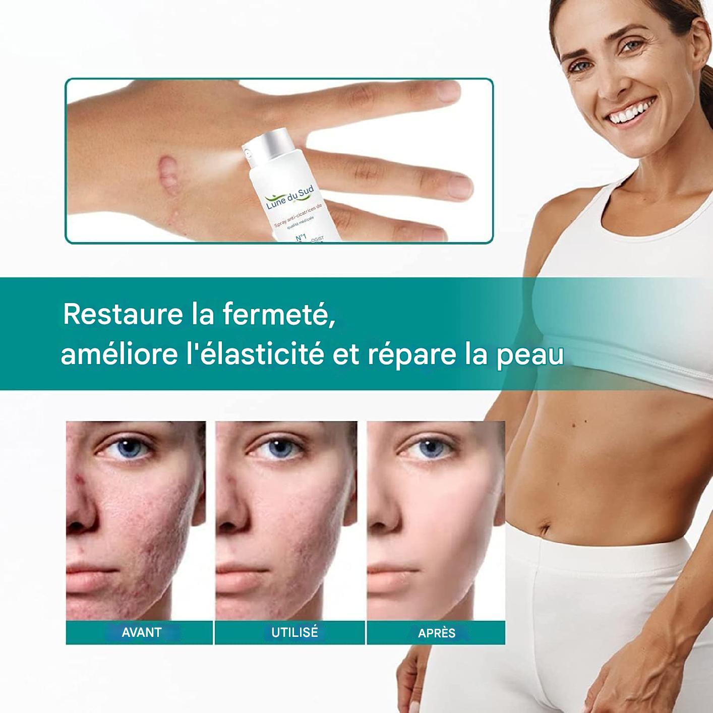 Spray Anti-Cicatrices Médical Grade.