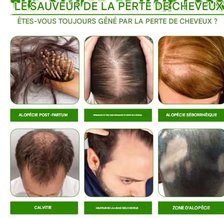 L'huile sérum de croissance capillaire