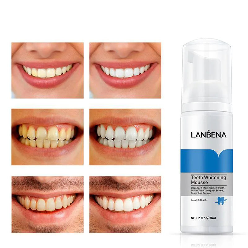 LANBENA-Mousse Nettoyante Et Blanchissante Pour Les Dents.