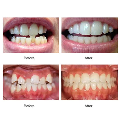 Appareil orthodontique.