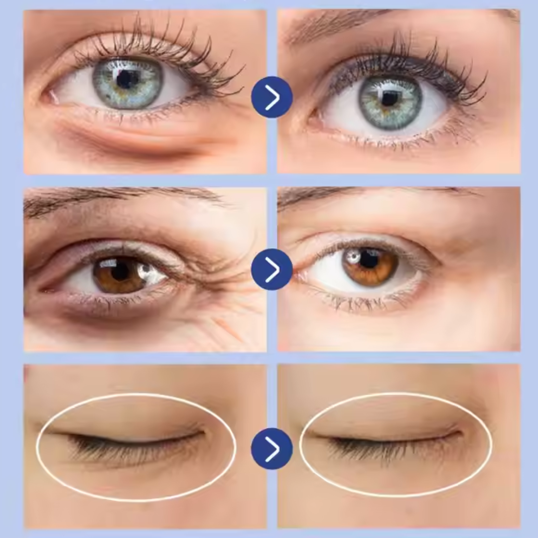 Crème contour des yeux multi-effets.