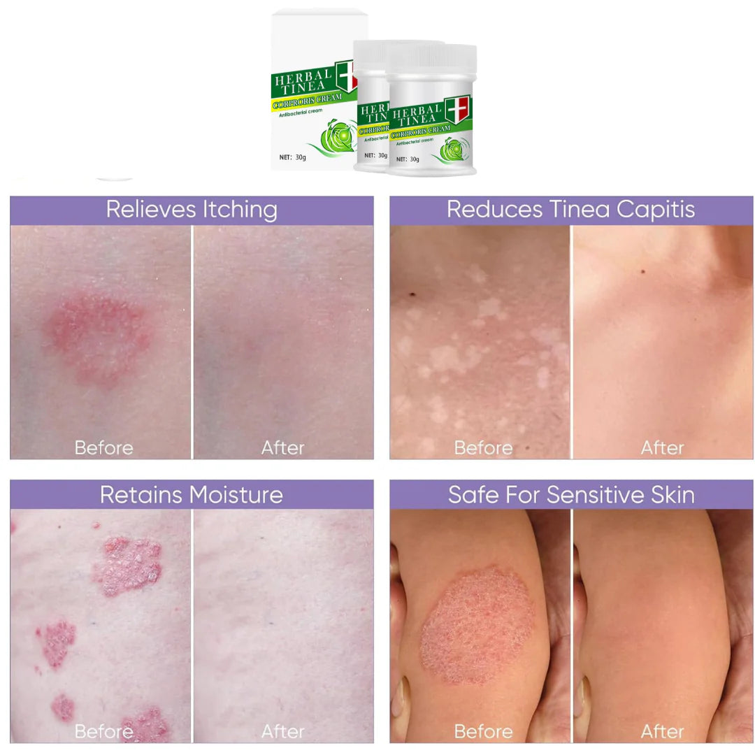 Herbal Tinea Crème; Pour une peau apaisée et saine.